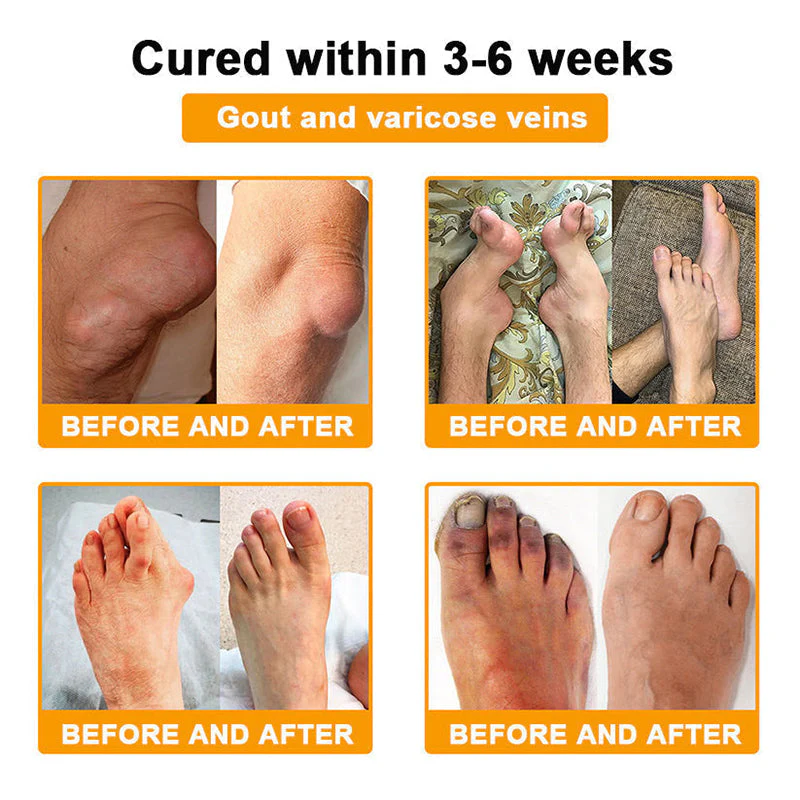 Official Only Store🇬🇧Healrize®🔥 BEE VENOM LITHOSPERMUM Pain-Relief Bone Healing Cream 👑👑(Specially for older adults) - Image 5