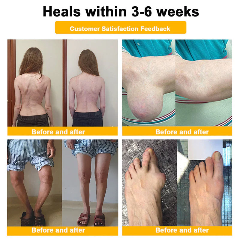 Official Only Store🇬🇧Healrize®🔥 BEE VENOM LITHOSPERMUM Pain-Relief Bone Healing Cream 👑👑(Specially for older adults) - Image 6