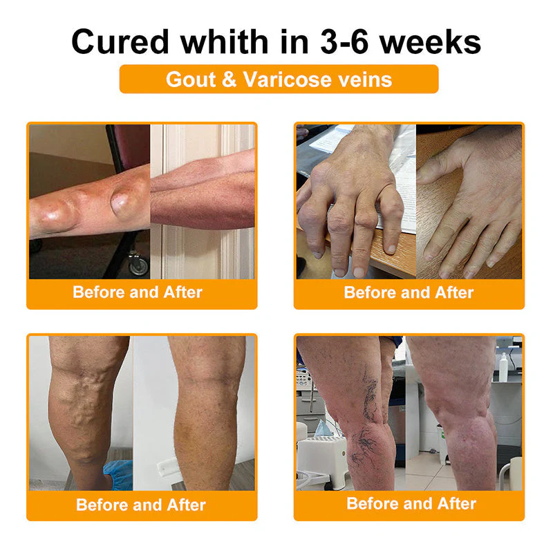 Official Only Store🇬🇧Healrize®🔥 BEE VENOM LITHOSPERMUM Pain-Relief Bone Healing Cream 👑👑(Specially for older adults) - Image 7