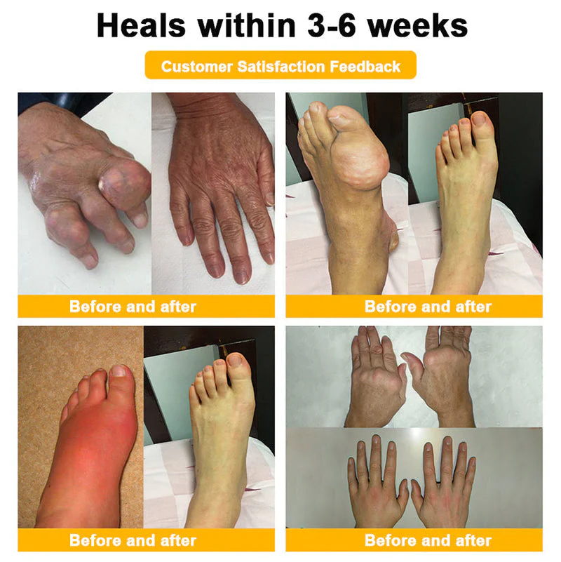 Official Only Store🇬🇧Healrize®🔥 BEE VENOM LITHOSPERMUM Pain-Relief Bone Healing Cream 👑👑(Specially for older adults) - Image 8